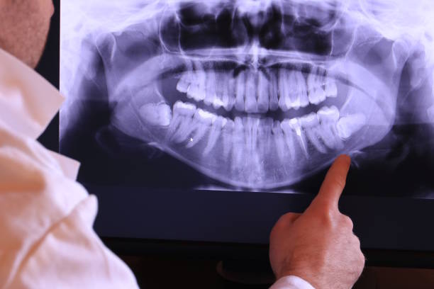 Best Dentist for Tooth Abscess  in Los Osos, CA